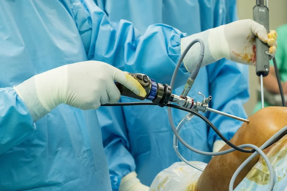Arthroscopic surgery knee