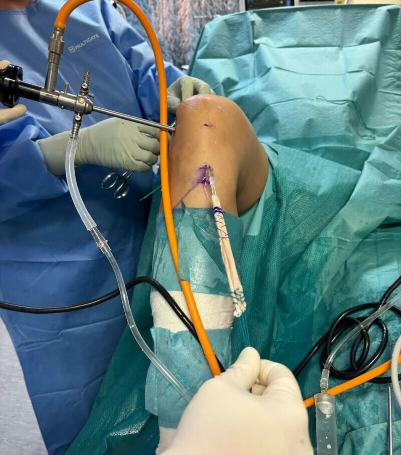 Dr Bryan Wang ACL Recon