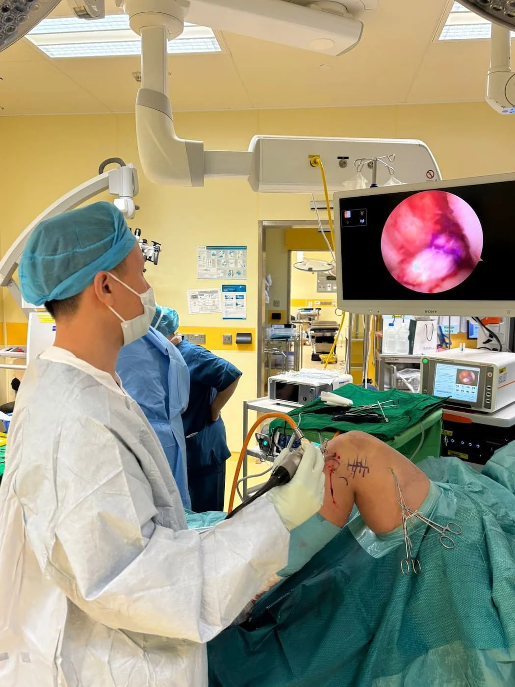 Dr Bryan keyhole surgery ACL reconstruction
