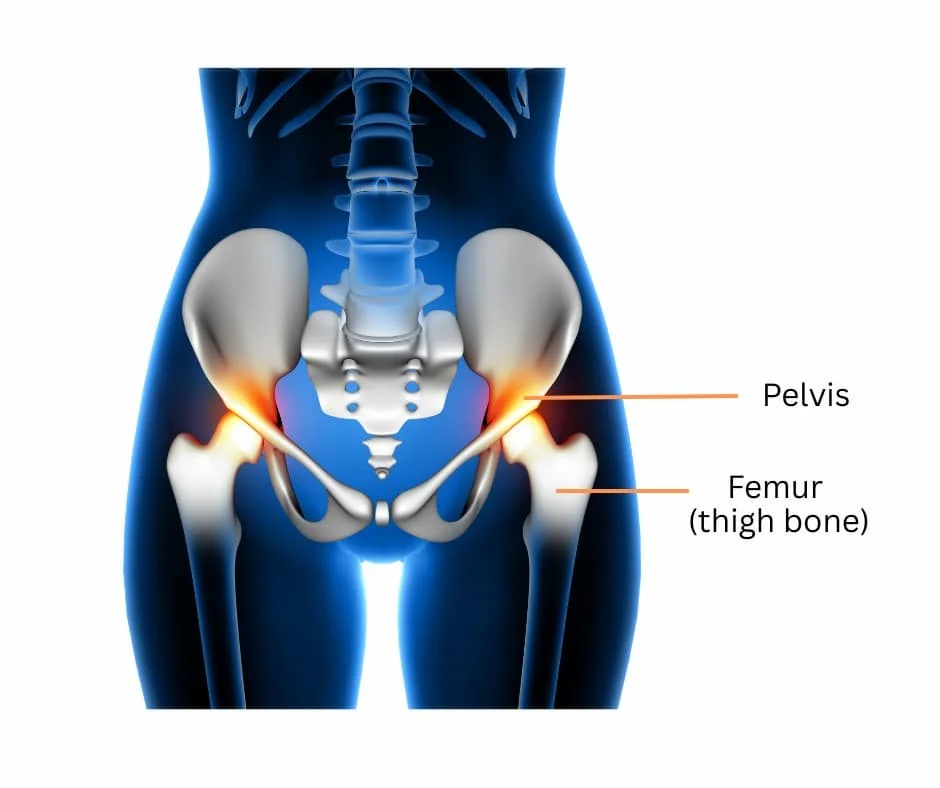 Hip joint infographic