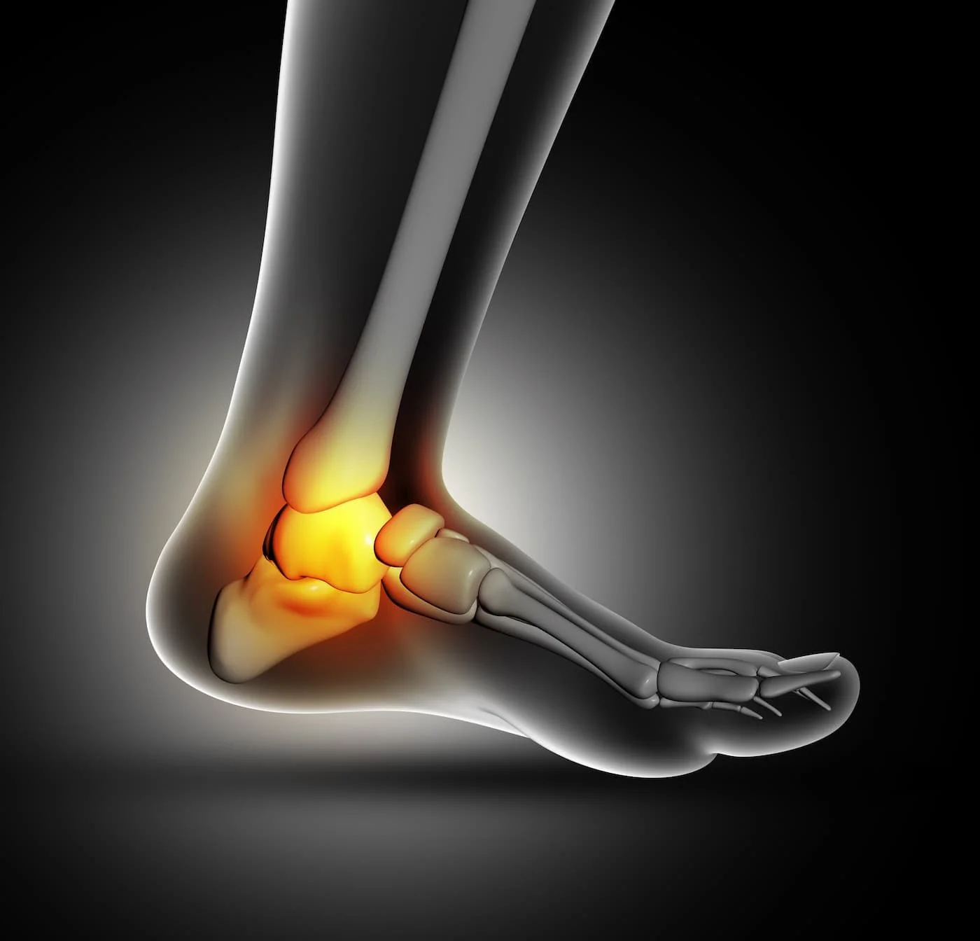 Ankle pain graphic
